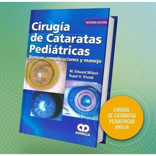 Cirugía De Cataratas Pediátricas  2 Ed. Técnicas.complic.
