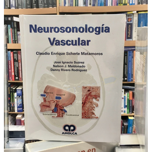 Neurosonología Vascular. Editorial Amolca