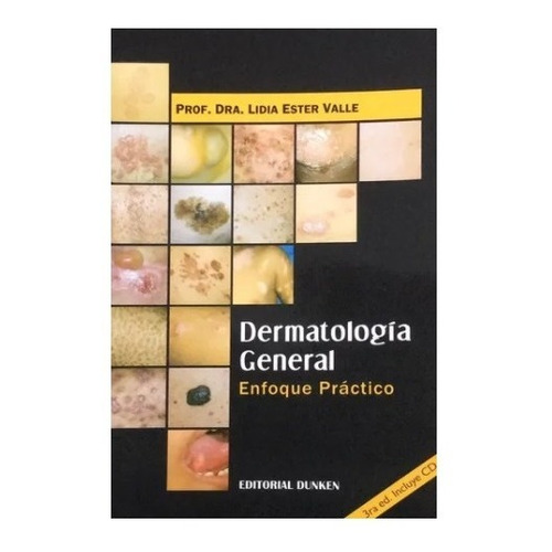 Dermatología General. Enfoque Práctico + Cd - Lidia Valle