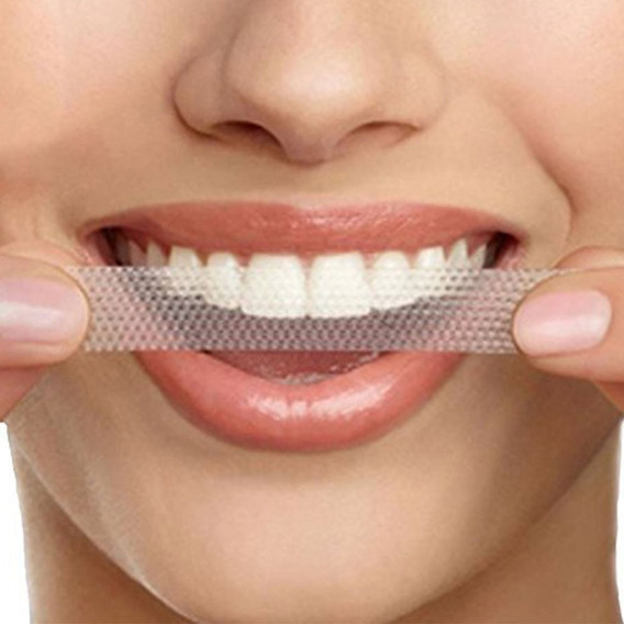 Blanqueamiento Dientes Blancos Luxe Dental Sonrie Y Ilumina 