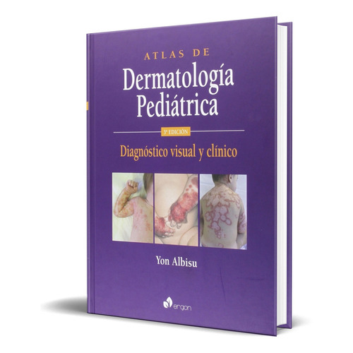 Atlas De Dermatologia Pediatrica, De Yon Albisu. Editorial Ergon, Tapa Dura En Español, 2015