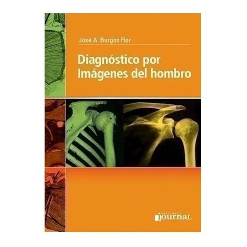 Diagnóstico Por Imágenes Del Hombro - Burgos Flor, José A.