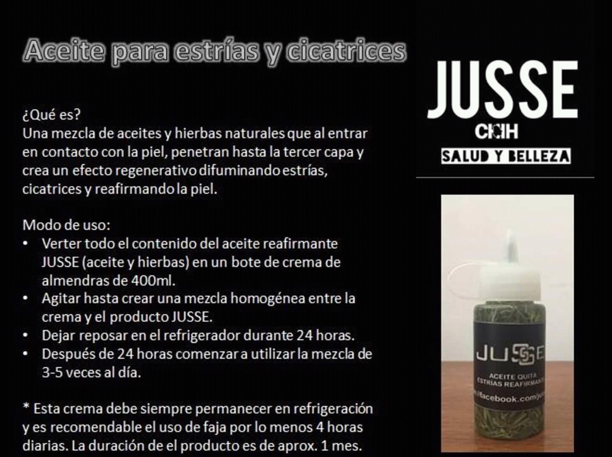 Aceite de almendras para estrías y celulitis Aceite de almendras para estrías y celulitis