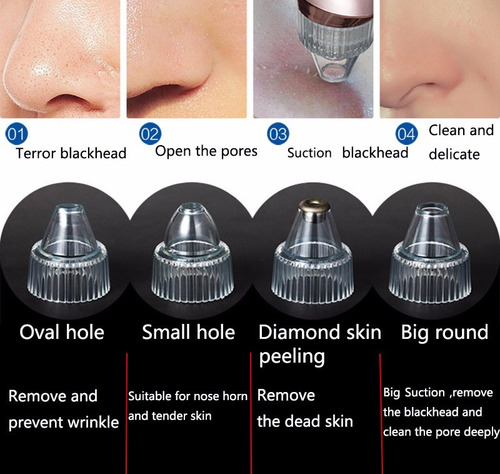 http2.mlstatic.com/aparelho-peeling-de-diamante-dermabraso-removedor-cravos-D_NQ_NP_704843-MLB25854579223_082017-O.jpg