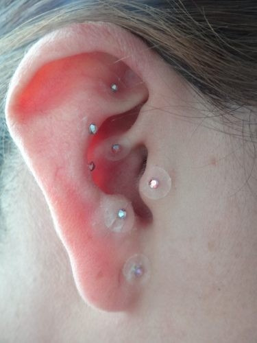 Balines en la oreja para bajar de peso