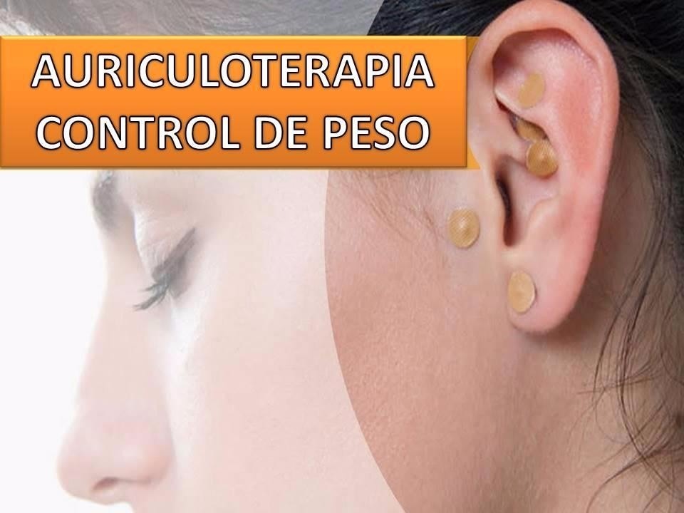 Tratamientos de imanes para bajar de peso