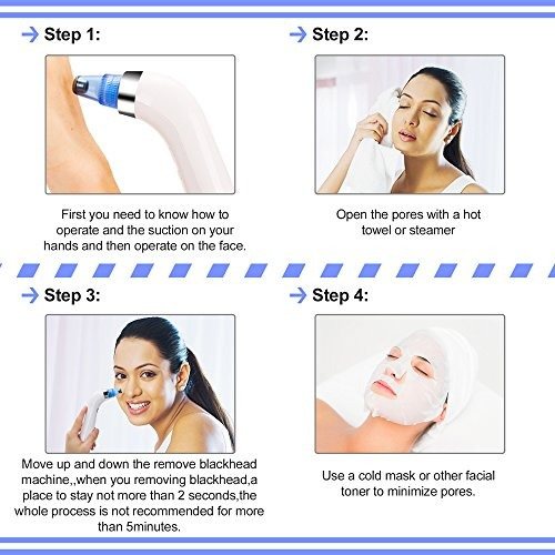 Sorry, facial pore vacuum Sorry, that facial pore vacuum sorry