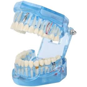 Dientes Dentales Modelo Acrílico Azul Transparente