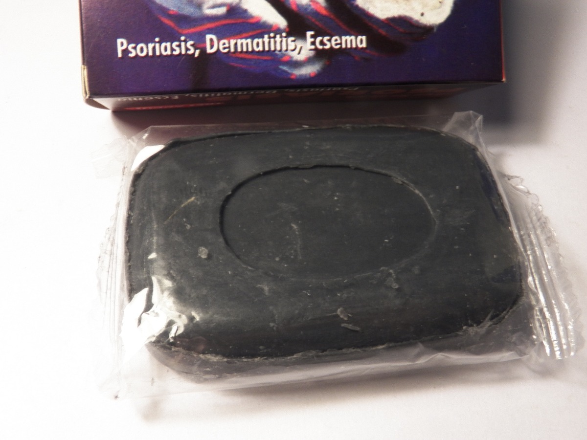 El tratamiento de la psoriasis del ungüento y la crema