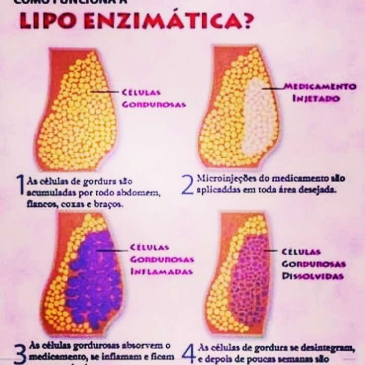 Lipo Enzimática Enzimas Emagrecedoras R 550 00 Em Mercado Livre