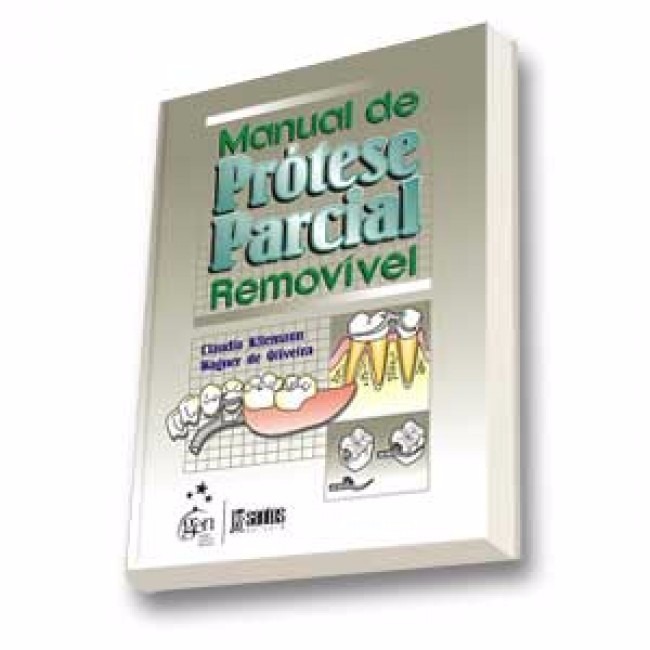 manual de protese parcial removivel kliemann