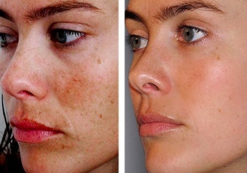 Micropeeling En Polvo Hidra Sparklin De Givenchy Alisa, Refresca E Ilumina La Piel 30g - $ 449.00 en Mercado Libre